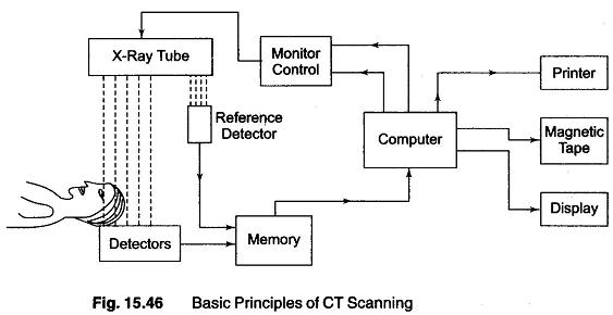 CT Scan Basic Principle